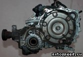 ���� VOLVO S80, V70, XC70 (B5254T2): ���� �1